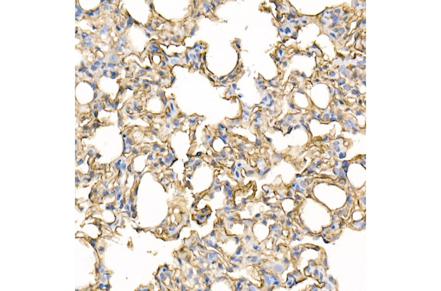 Immunohistochemistry - Anti-ICAM1 Antibody (A306660) - Antibodies.com