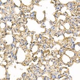 Immunohistochemistry - Anti-ICAM1 Antibody (A306660) - Antibodies.com