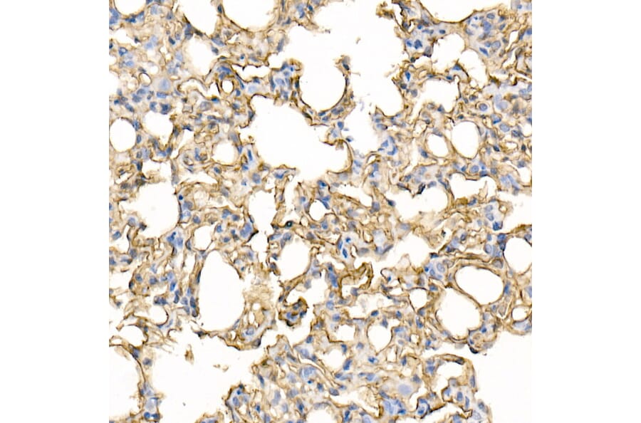 Immunohistochemistry - Anti-ICAM1 Antibody (A306660) - Antibodies.com
