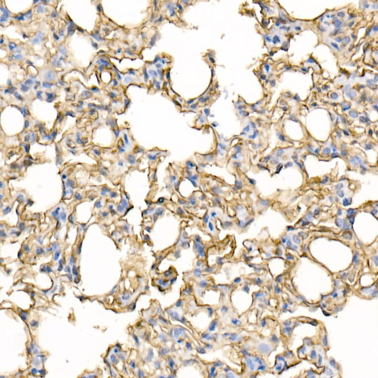 Immunohistochemistry - Anti-ICAM1 Antibody (A306660) - Antibodies.com