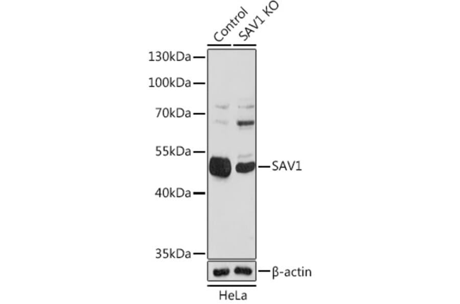 Western Blot - Anti-SAV1 Antibody (A306668) - Antibodies.com