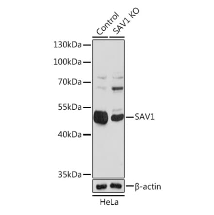 Western Blot - Anti-SAV1 Antibody (A306668) - Antibodies.com