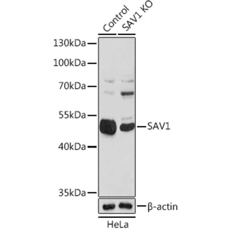 Western Blot - Anti-SAV1 Antibody (A306668) - Antibodies.com