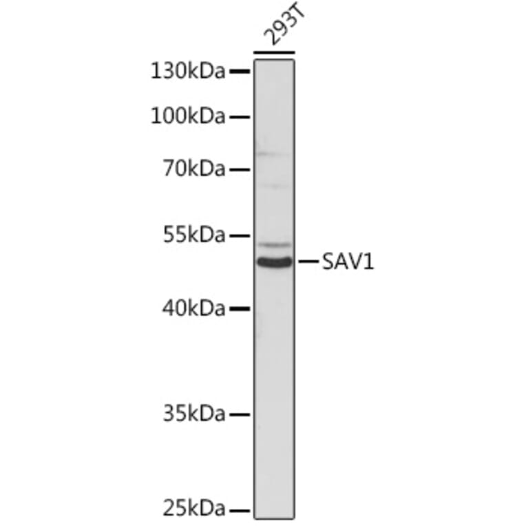 Western Blot - Anti-SAV1 Antibody (A306668) - Antibodies.com