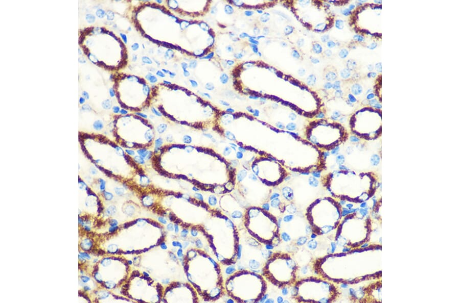 Immunohistochemistry - Anti-SAV1 Antibody (A306668) - Antibodies.com