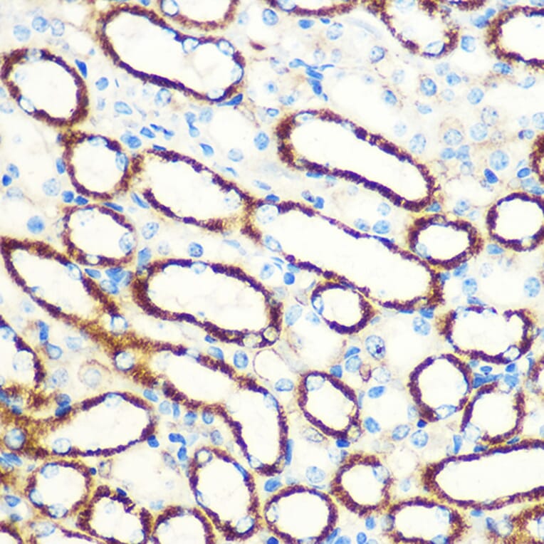 Immunohistochemistry - Anti-SAV1 Antibody (A306668) - Antibodies.com