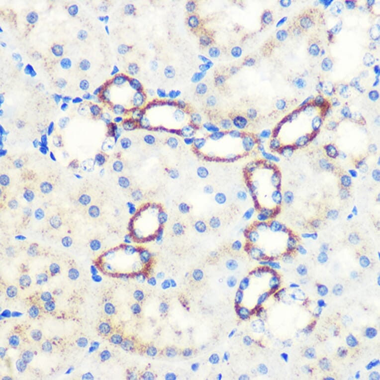 Immunohistochemistry - Anti-SAV1 Antibody (A306668) - Antibodies.com