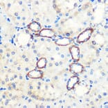 Immunohistochemistry - Anti-SAV1 Antibody (A306668) - Antibodies.com