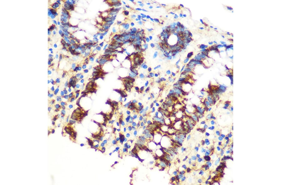 Immunohistochemistry - Anti-SAV1 Antibody (A306668) - Antibodies.com