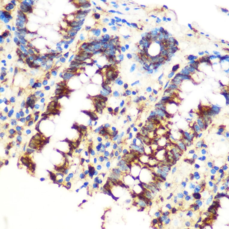 Immunohistochemistry - Anti-SAV1 Antibody (A306668) - Antibodies.com