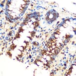 Immunohistochemistry - Anti-SAV1 Antibody (A306668) - Antibodies.com