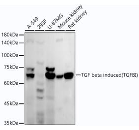Western Blot - Anti-TGFBI Antibody [ARC52500] (A306671) - Antibodies.com