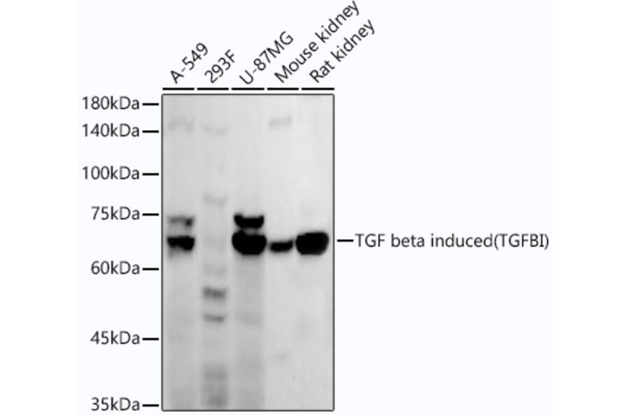 Western Blot - Anti-TGFBI Antibody [ARC52500] (A306671) - Antibodies.com