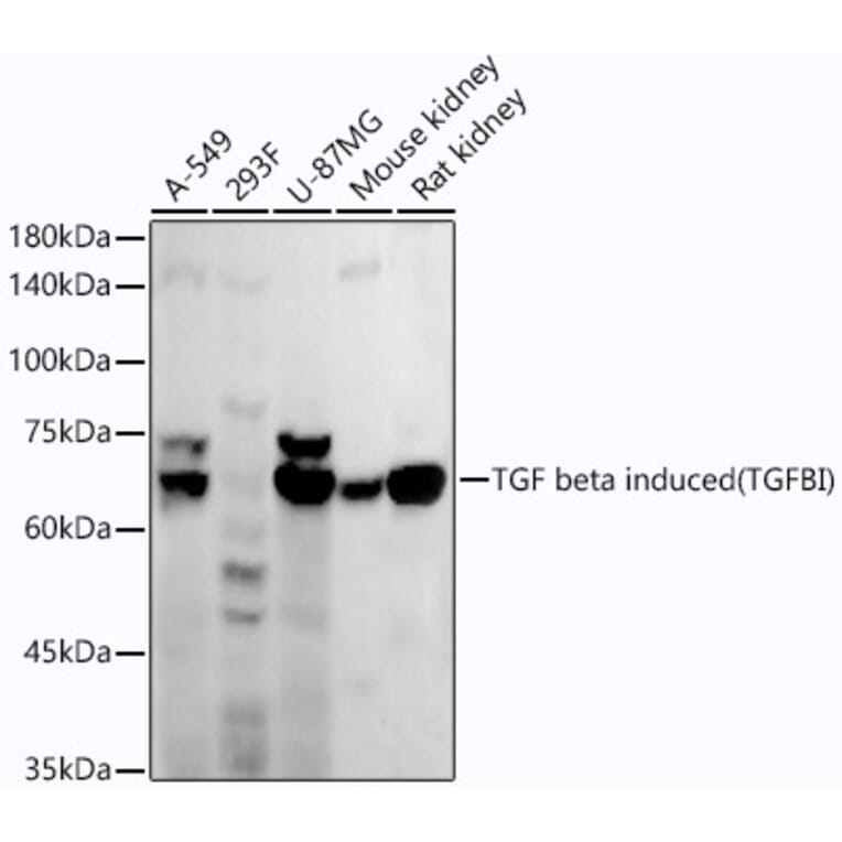 Western Blot - Anti-TGFBI Antibody [ARC52500] (A306671) - Antibodies.com