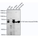 Western Blot - Anti-TGFBI Antibody [ARC52500] (A306671) - Antibodies.com