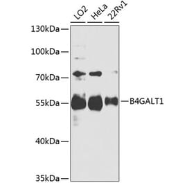 Western Blot - Anti-B4GALT1 Antibody (A306673) - Antibodies.com