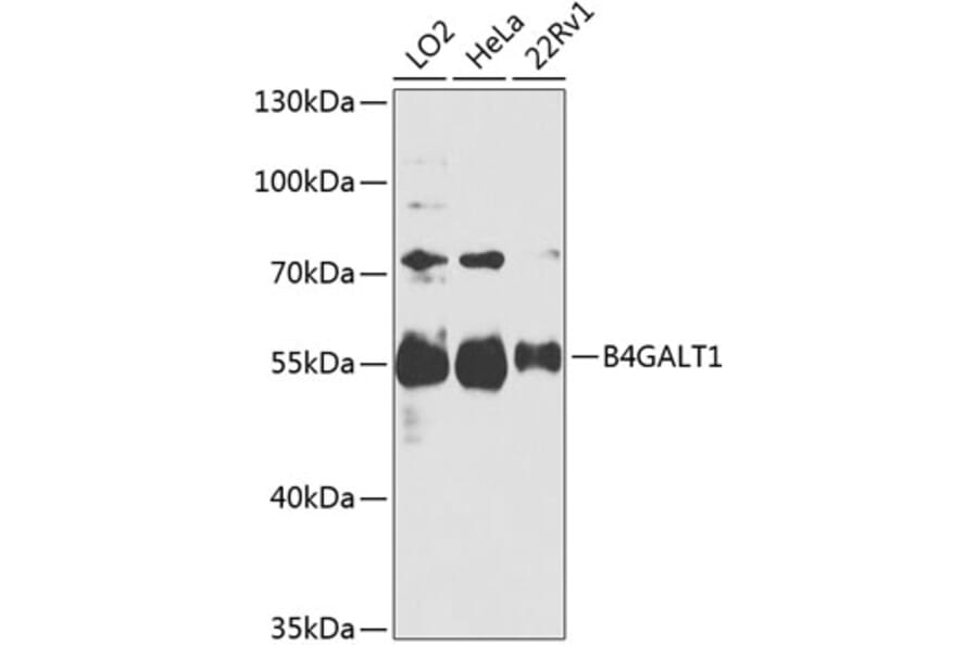 Western Blot - Anti-B4GALT1 Antibody (A306673) - Antibodies.com