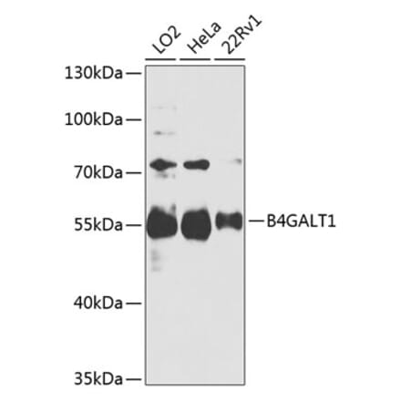 Western Blot - Anti-B4GALT1 Antibody (A306673) - Antibodies.com