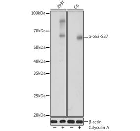 Western Blot - Anti-p53 (phospho Ser37) Antibody (A306674) - Antibodies.com