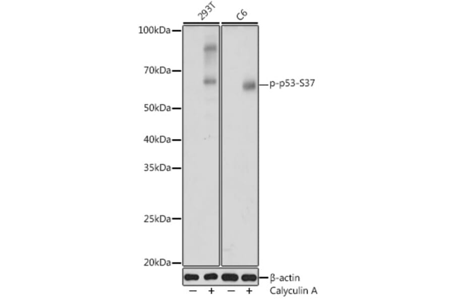 Western Blot - Anti-p53 (phospho Ser37) Antibody (A306674) - Antibodies.com