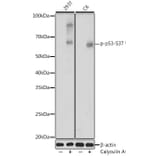 Western Blot - Anti-p53 (phospho Ser37) Antibody (A306674) - Antibodies.com
