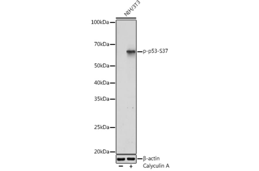 Western Blot - Anti-p53 (phospho Ser37) Antibody (A306674) - Antibodies.com
