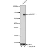 Western Blot - Anti-p53 (phospho Ser37) Antibody (A306674) - Antibodies.com