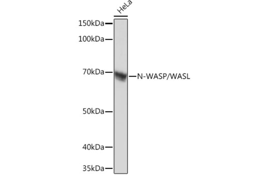 Western Blot - Anti-N WASP Antibody [ARC0737] (A306675) - Antibodies.com