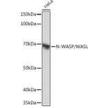 Western Blot - Anti-N WASP Antibody [ARC0737] (A306675) - Antibodies.com