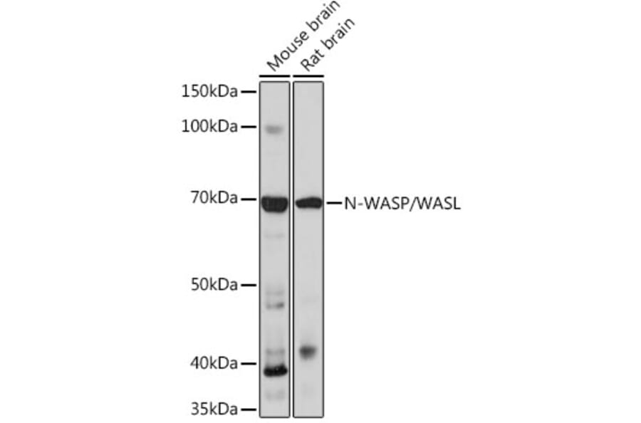 Western Blot - Anti-N WASP Antibody [ARC0737] (A306675) - Antibodies.com