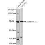 Western Blot - Anti-N WASP Antibody [ARC0737] (A306675) - Antibodies.com