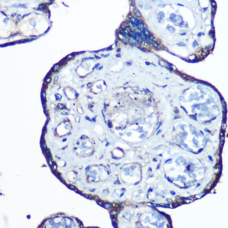 Immunohistochemistry - Anti-N WASP Antibody [ARC0737] (A306675) - Antibodies.com