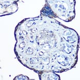 Immunohistochemistry - Anti-N WASP Antibody [ARC0737] (A306675) - Antibodies.com