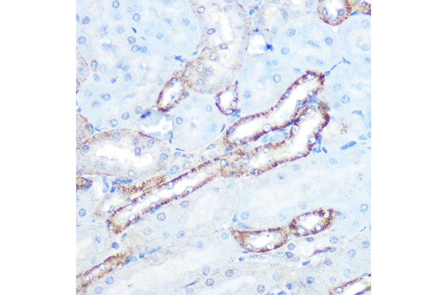 Immunohistochemistry - Anti-N WASP Antibody [ARC0737] (A306675) - Antibodies.com