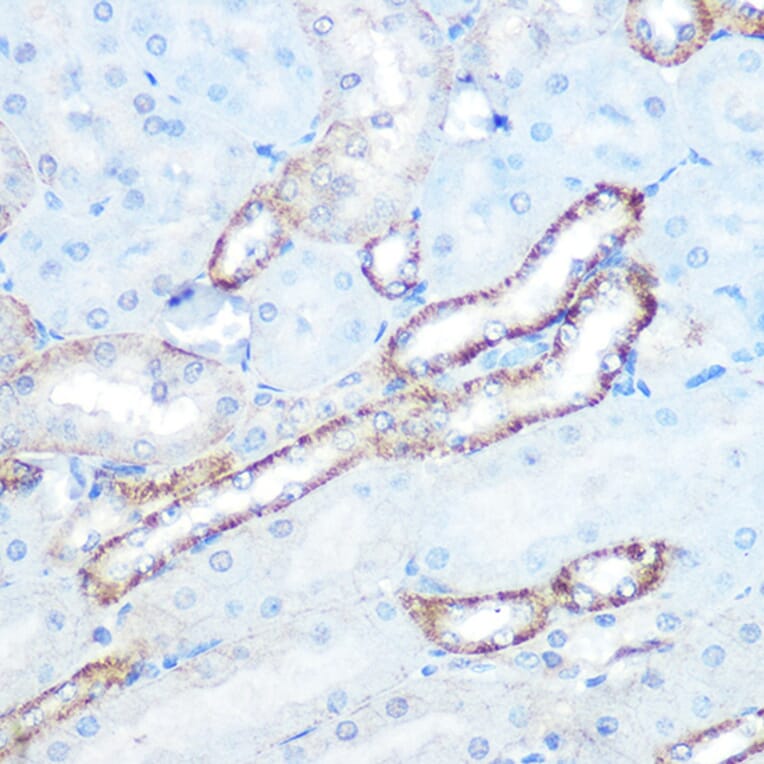 Immunohistochemistry - Anti-N WASP Antibody [ARC0737] (A306675) - Antibodies.com