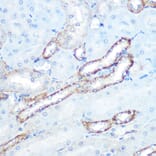 Immunohistochemistry - Anti-N WASP Antibody [ARC0737] (A306675) - Antibodies.com