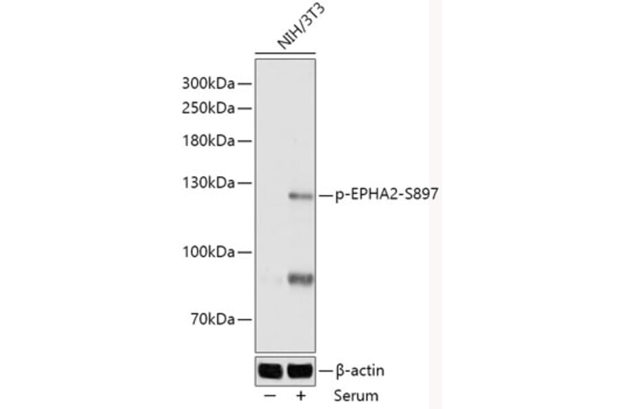 Western Blot - Anti-Eph receptor A2 (phospho Ser897) Antibody (A306676) - Antibodies.com