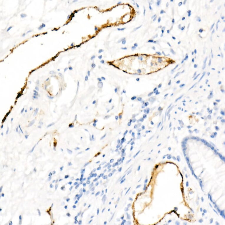 Immunohistochemistry - Anti-Von Willebrand Factor Antibody [ARC52173] (A306677) - Antibodies.com