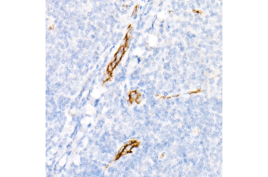 Immunohistochemistry - Anti-Von Willebrand Factor Antibody [ARC52173] (A306677) - Antibodies.com