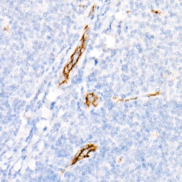 Immunohistochemistry - Anti-Von Willebrand Factor Antibody [ARC52173] (A306677) - Antibodies.com