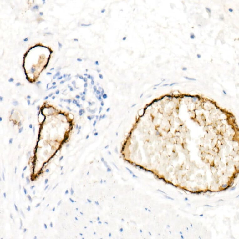Immunohistochemistry - Anti-Von Willebrand Factor Antibody [ARC52173] (A306677) - Antibodies.com