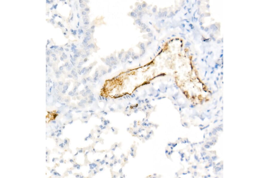 Immunohistochemistry - Anti-Von Willebrand Factor Antibody [ARC52173] (A306677) - Antibodies.com