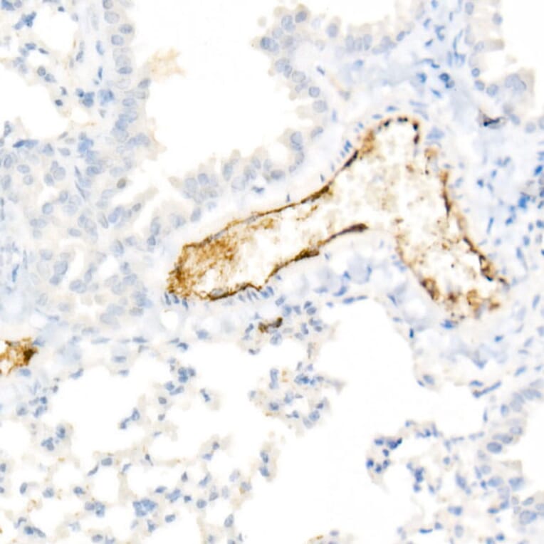 Immunohistochemistry - Anti-Von Willebrand Factor Antibody [ARC52173] (A306677) - Antibodies.com