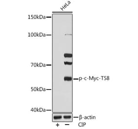 Western Blot - Anti-c-Myc (phospho Thr58) Antibody (A306678) - Antibodies.com