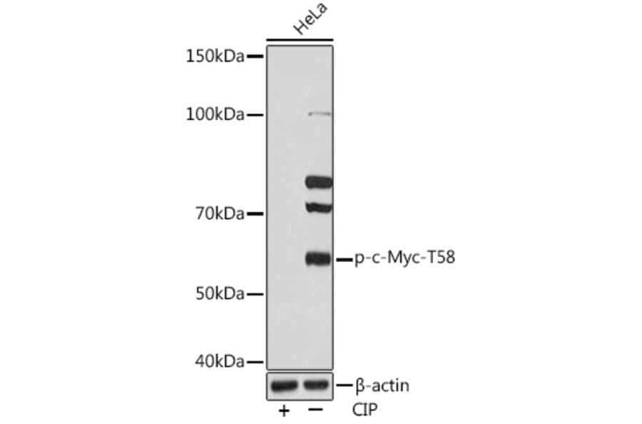 Western Blot - Anti-c-Myc (phospho Thr58) Antibody [ARC1534] (A306678) - Antibodies.com