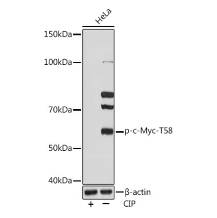 Western Blot - Anti-c-Myc (phospho Thr58) Antibody (A306678) - Antibodies.com