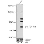 Western Blot - Anti-c-Myc (phospho Thr58) Antibody [ARC1534] (A306678) - Antibodies.com