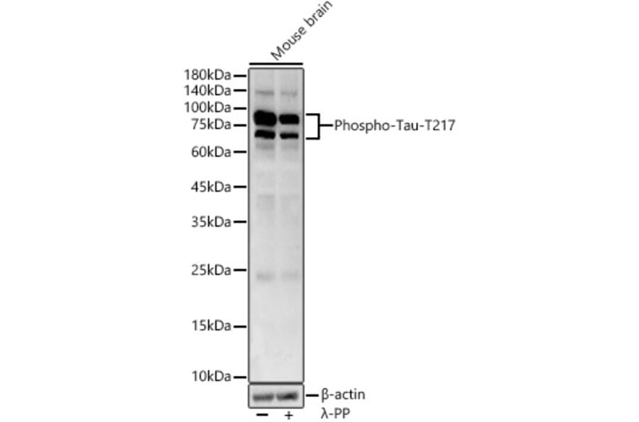 Western Blot - Anti-Tau (phospho Thr217) Antibody (A306679) - Antibodies.com