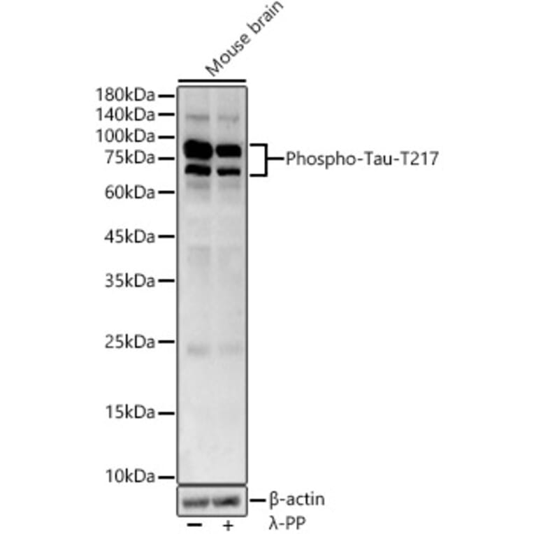 Western Blot - Anti-Tau (phospho Thr217) Antibody (A306679) - Antibodies.com