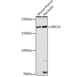 Western Blot - Anti-CSB Antibody (A306681) - Antibodies.com